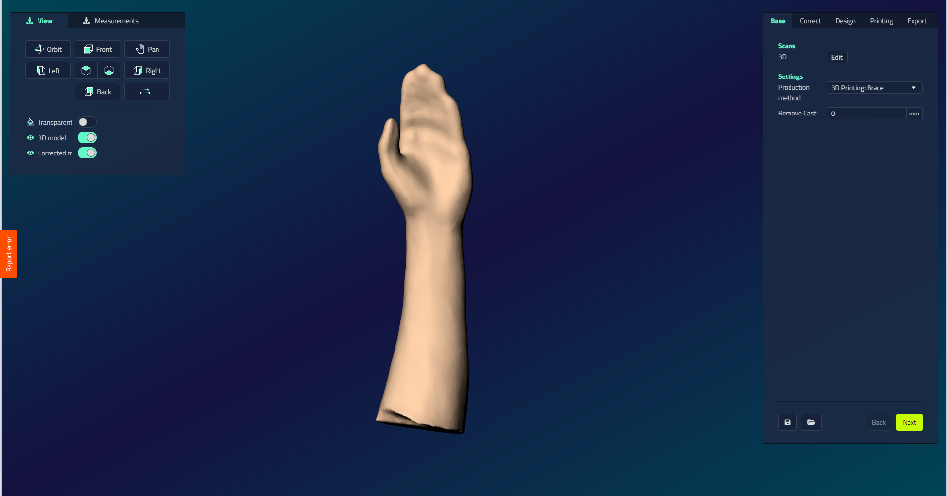 The Base step of a hand splint, showing the Scans section with a 3D Edit button, and Settings with the Production method dropdown set to 3D Printing: Brace and a Remove Cast field